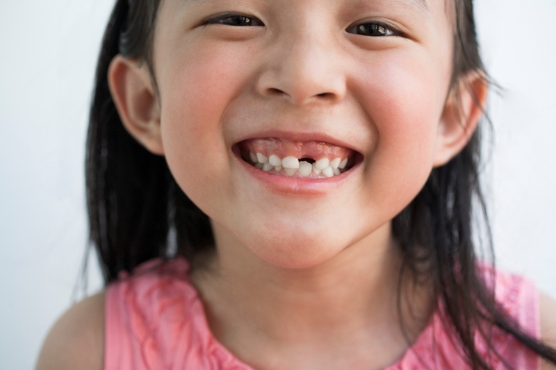 Por que guardar os dentes de leite do seu filho pode ser uma boa ideia para o futuro