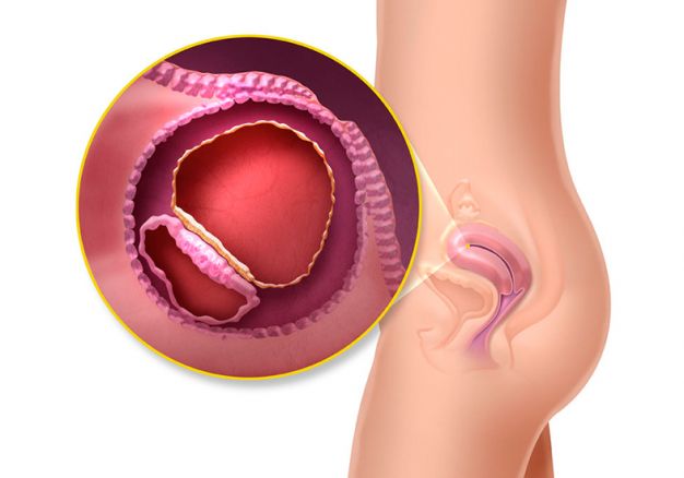 O que acontece na 3ª semana de gestação: sintomas e crescimento do bebê