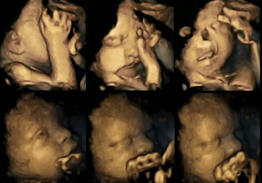 Estudo mostra em imagens como o cigarro afeta o bebê durante a gravidez