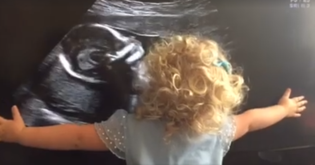 Menina de 2 anos se emociona ao ver ultrassom da irmã pela 1ª vez