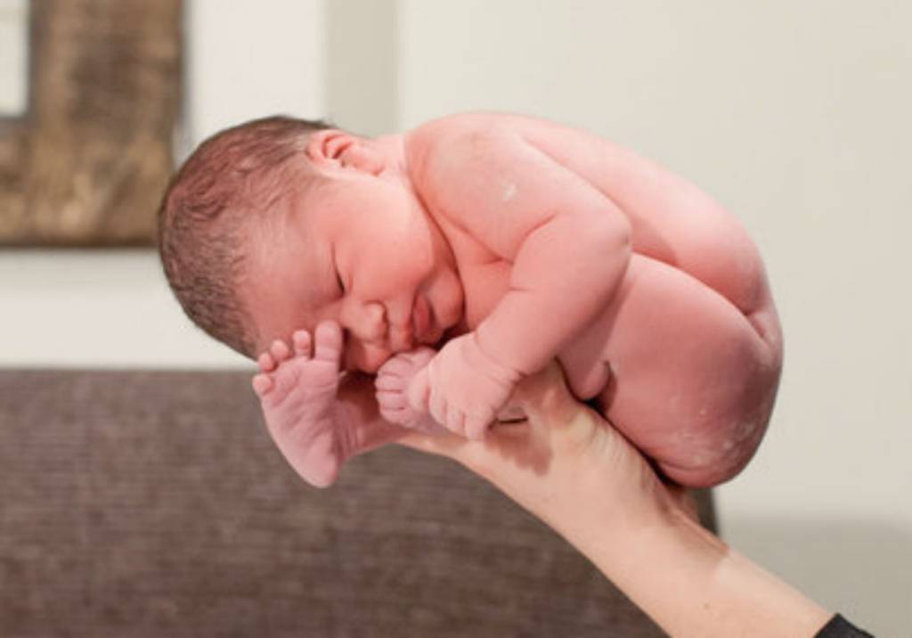 Fotos durante o parto mostram como bebês cabem no útero materno