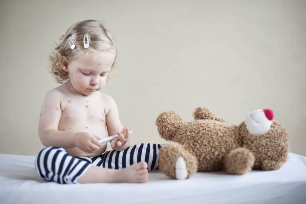 Catapora: o que é, sintomas e tratamento