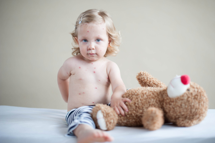 9 Doencas Comuns Entre As Criancas Durante A Primavera Bebe Com Br