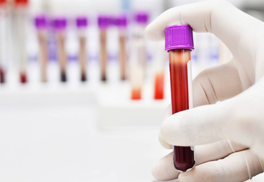 Planos de saúde poderão ser obrigados a cobrir exames que detectam zika