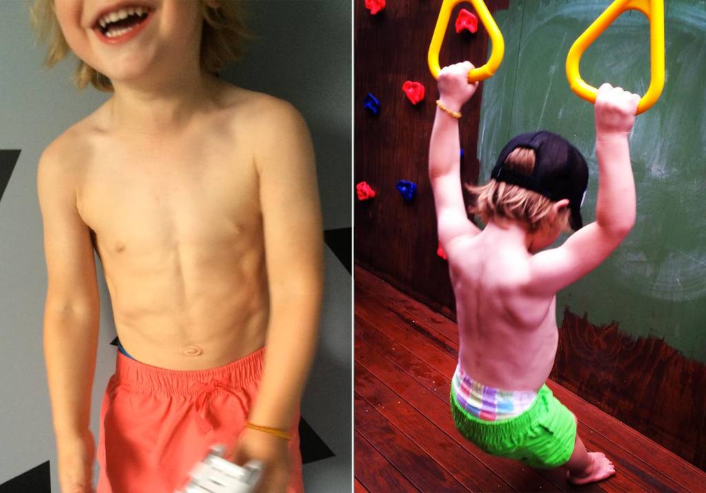 Menino musculoso de apenas 3 anos levanta discussão sobre excesso de atividades físicas na infância