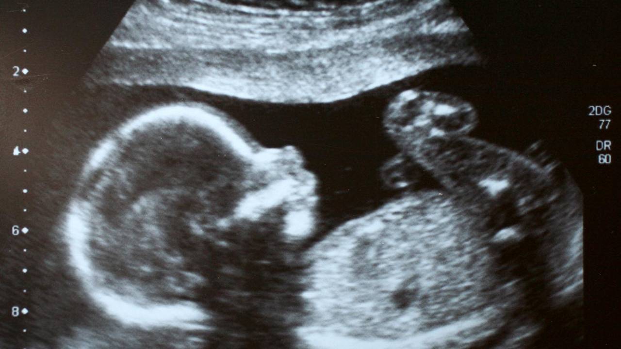 Ultrassom: imagem de bebê dentro da barriga. É possível identificar todo seu corpinho.