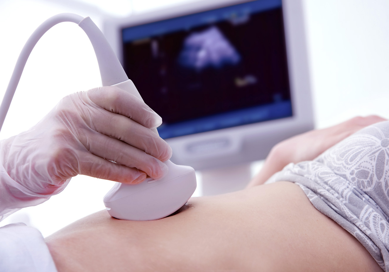Mulher grávida fazendo exame de ultrassom. A foto está foca na barriga dela. Tem pele clara. O aparelho está sendo segurado por uma mão com luva. Ao fundo, é possível ver o monitor.