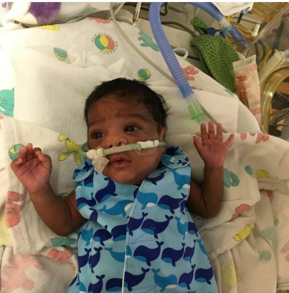 Mãe de prematuro confecciona roupas para bebês de UTI neonatal