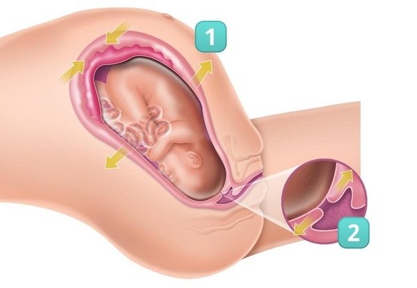 1ª fase: dilatação 1ª fase: dilatação