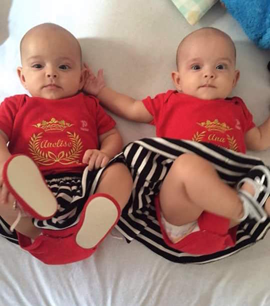 bebes-carecas-facebook bebes-carecas-facebook