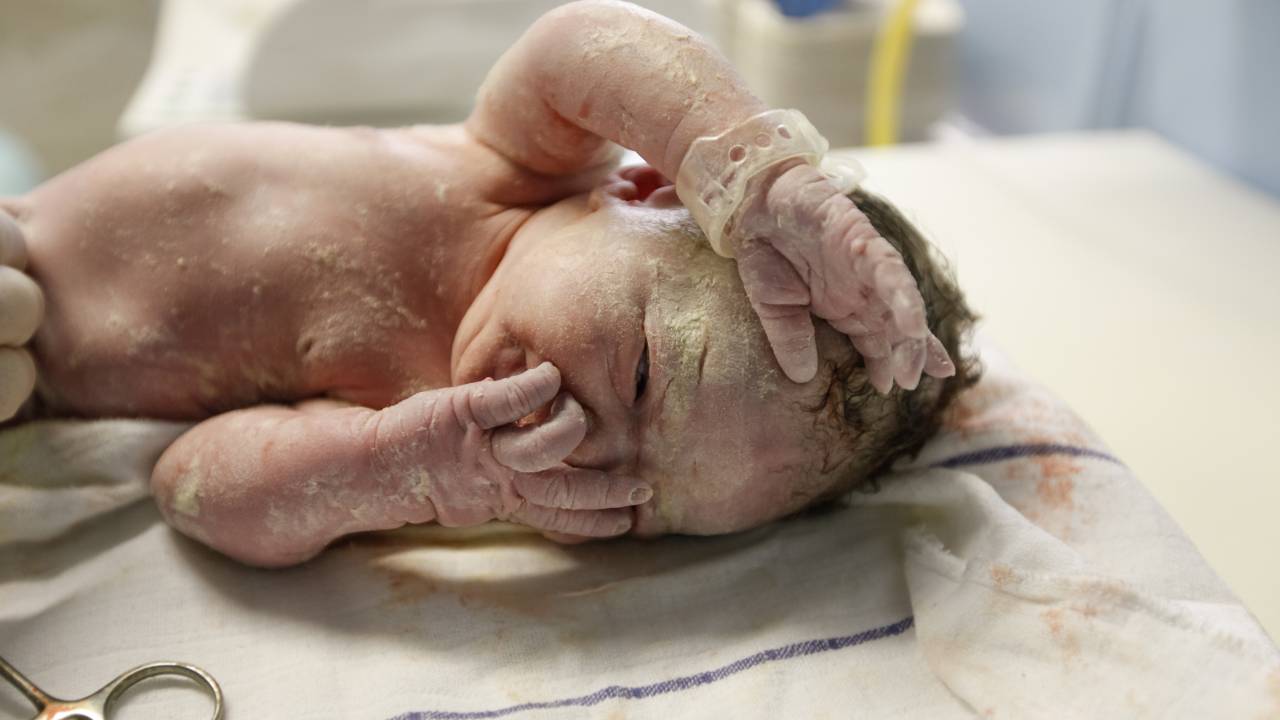 Recém-nascido coberto de vérnix deitado sobre tecido branco. Está com uma mãozinha em cima da boca/nariz e outra na testa