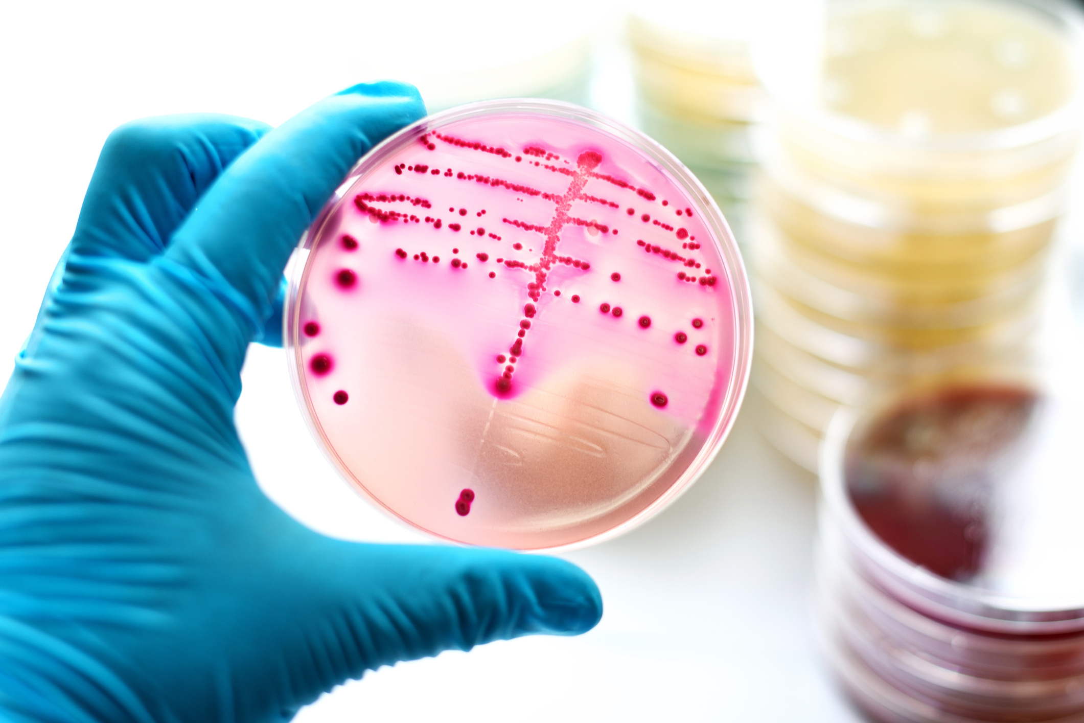 placa de cultura de bactérias senso segurada por uma mão com luva azul. A placa de bactéria tem pontinhas cor de rosa.