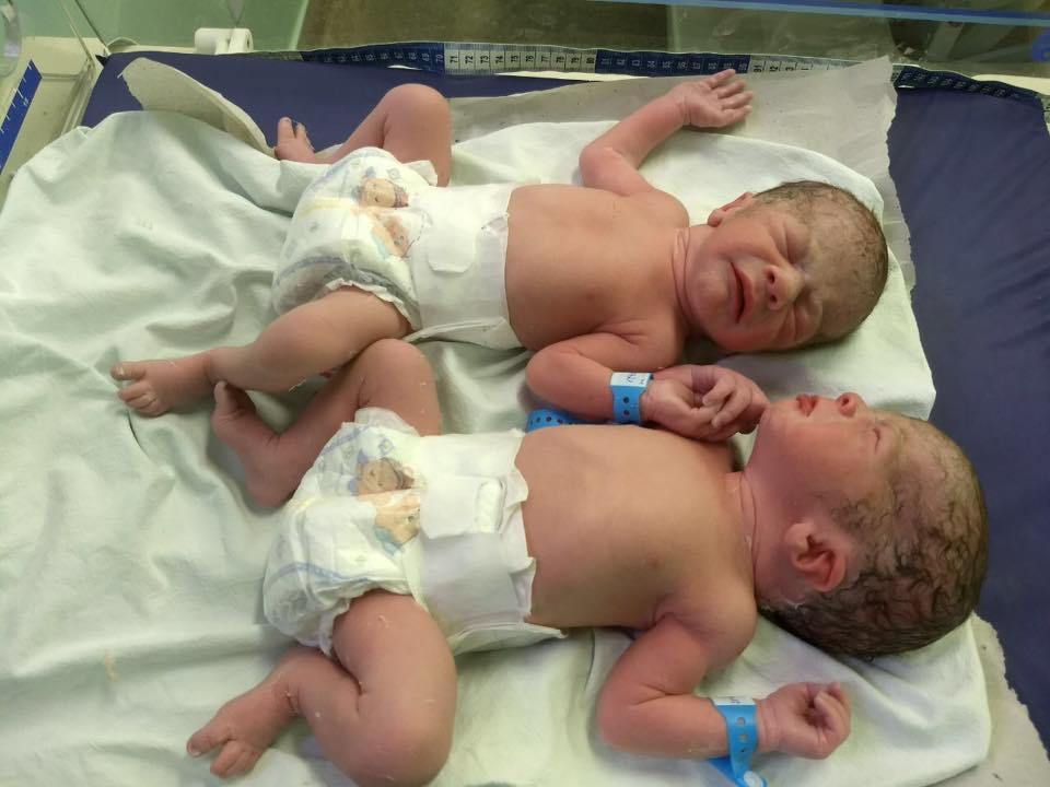 Irmãos gêmeos ficam de mãos dadas após o parto e foto viraliza