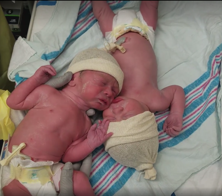 Amor de irmão: vídeo mostra o vínculo especial entre bebês gêmeos