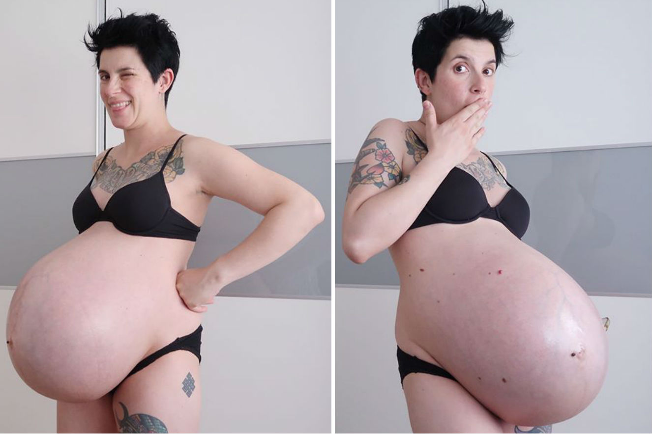 Mãe de gêmeos publica foto de barriga no pós-parto: "realidade"