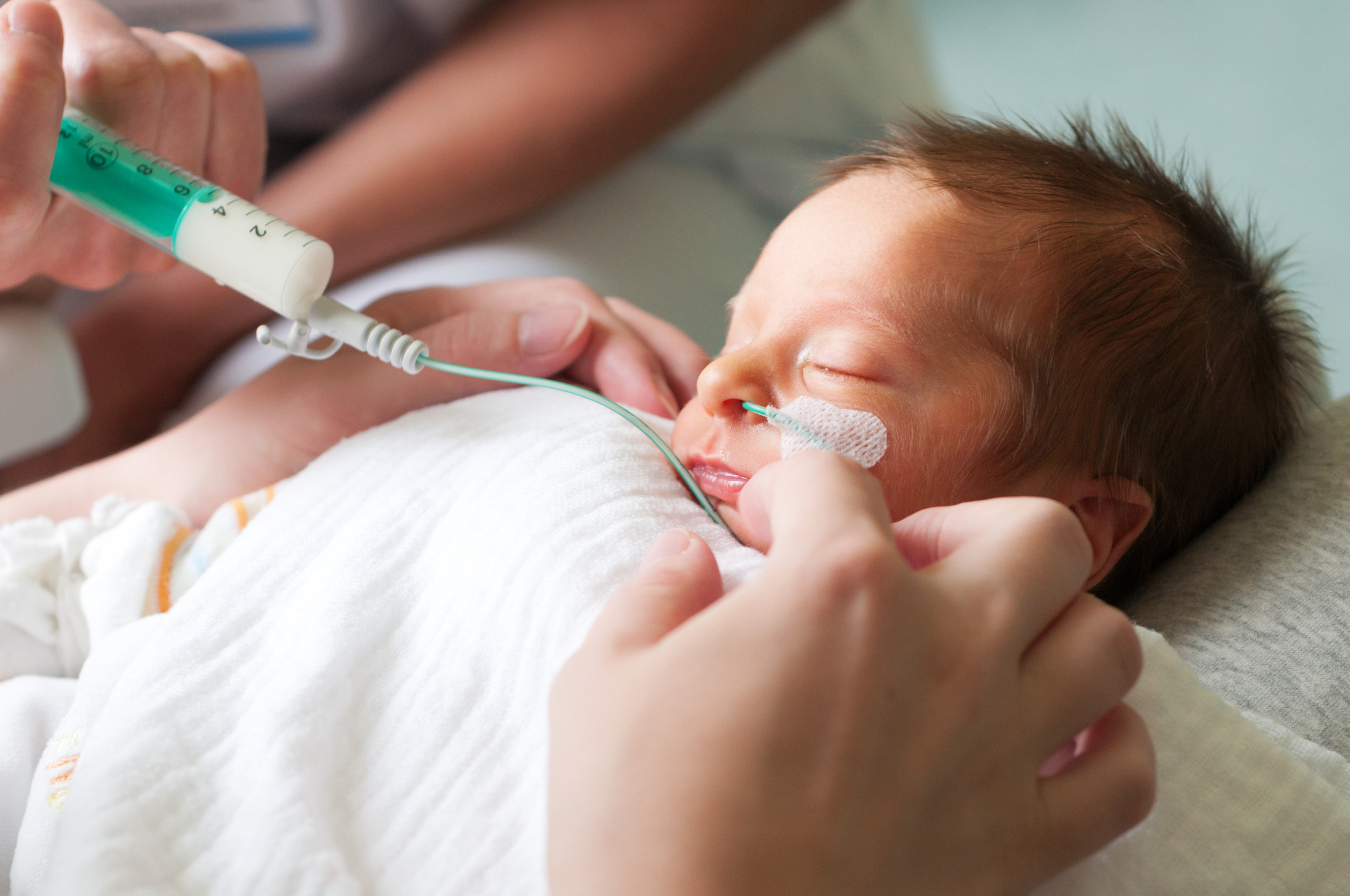 Bebê prematuro recebendo leite na seringa