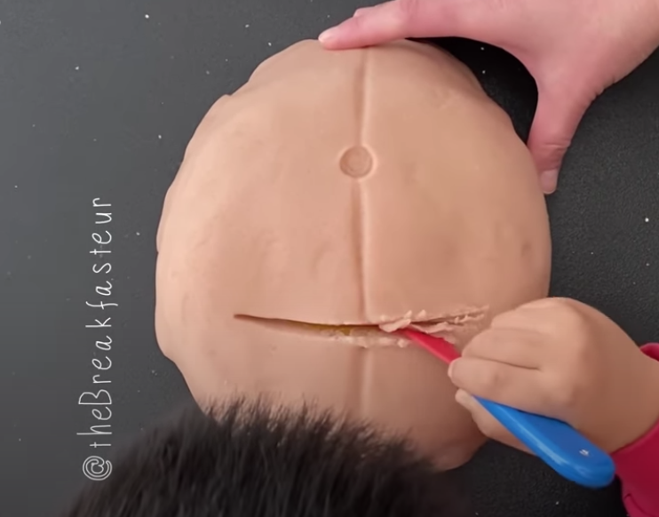 Viralizou: mãe médica ensina cesárea para o filho com barriga de massinha