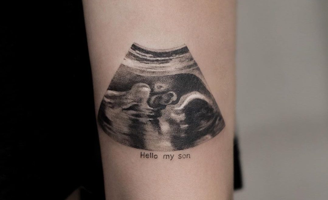 Tatuagem de um ultrassom