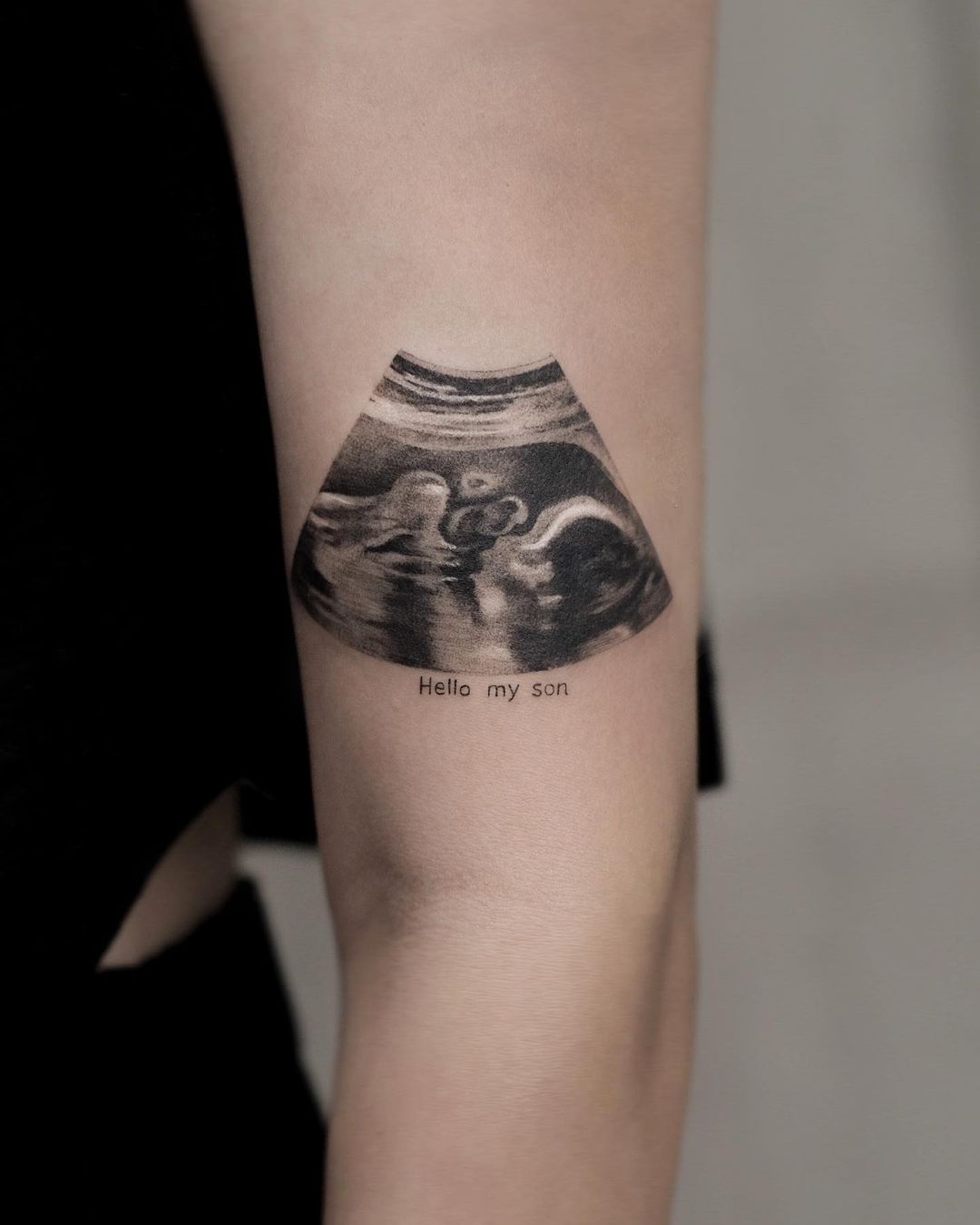 Tatuagem de um ultrassom