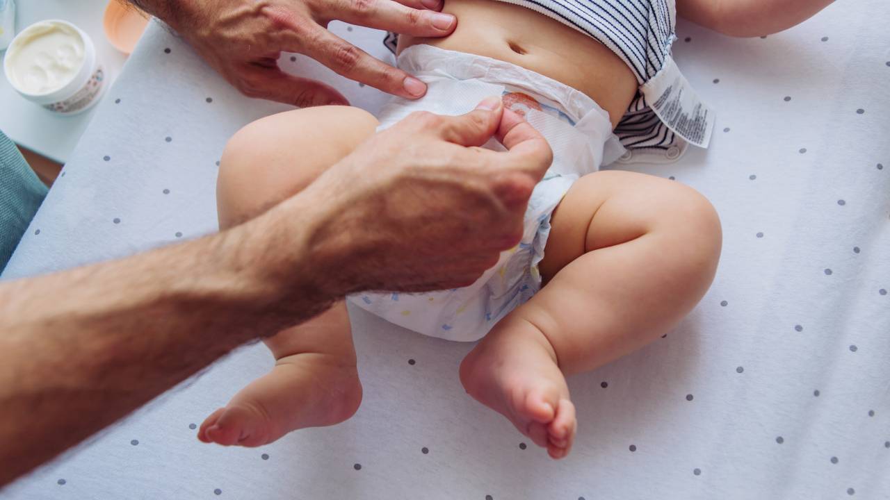 Cocô ácido em bebês:Saiba identificar e conheça como prevenir as assaduras