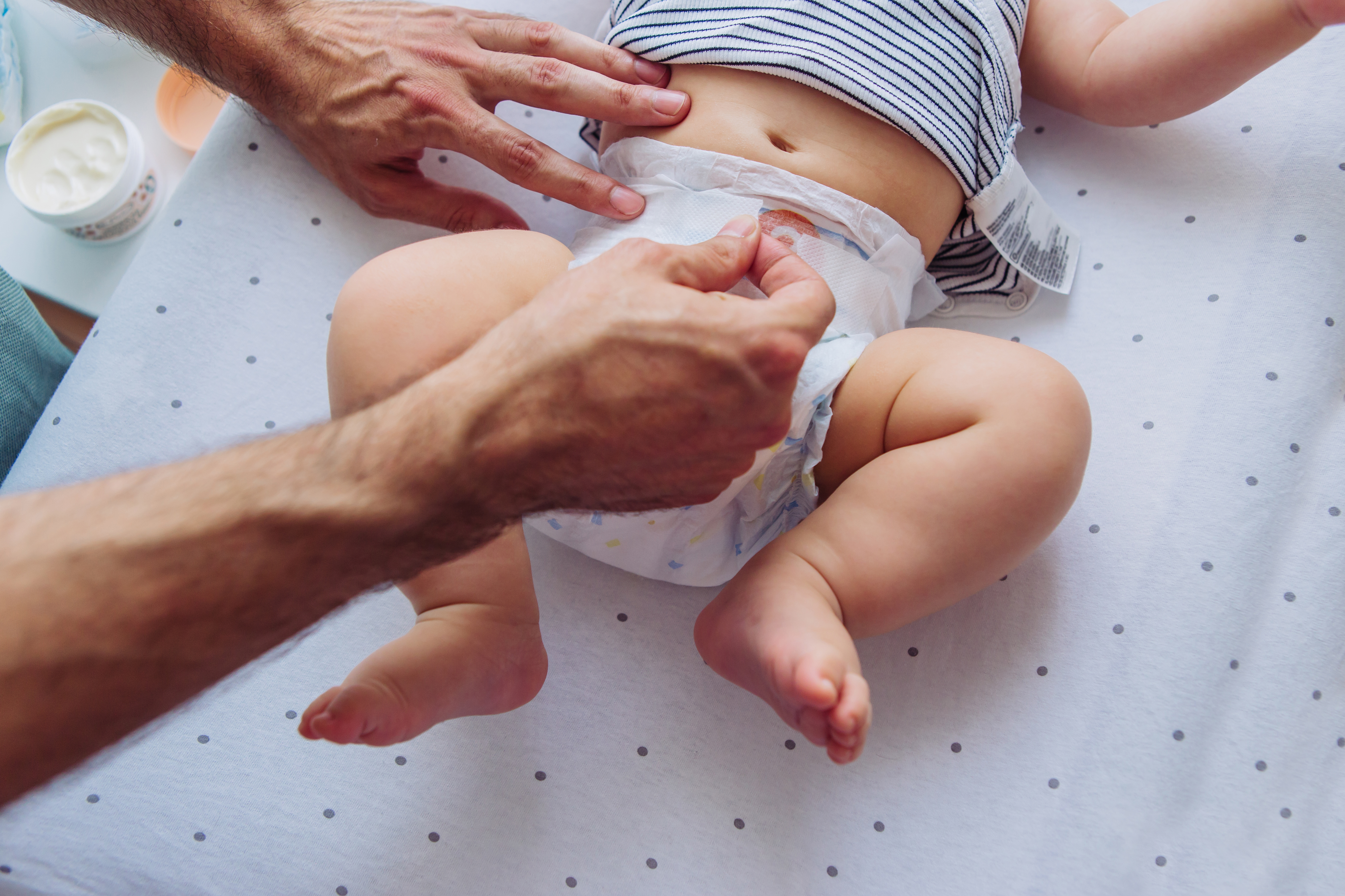 Cocô ácido em bebês:Saiba identificar e conheça como prevenir as assaduras