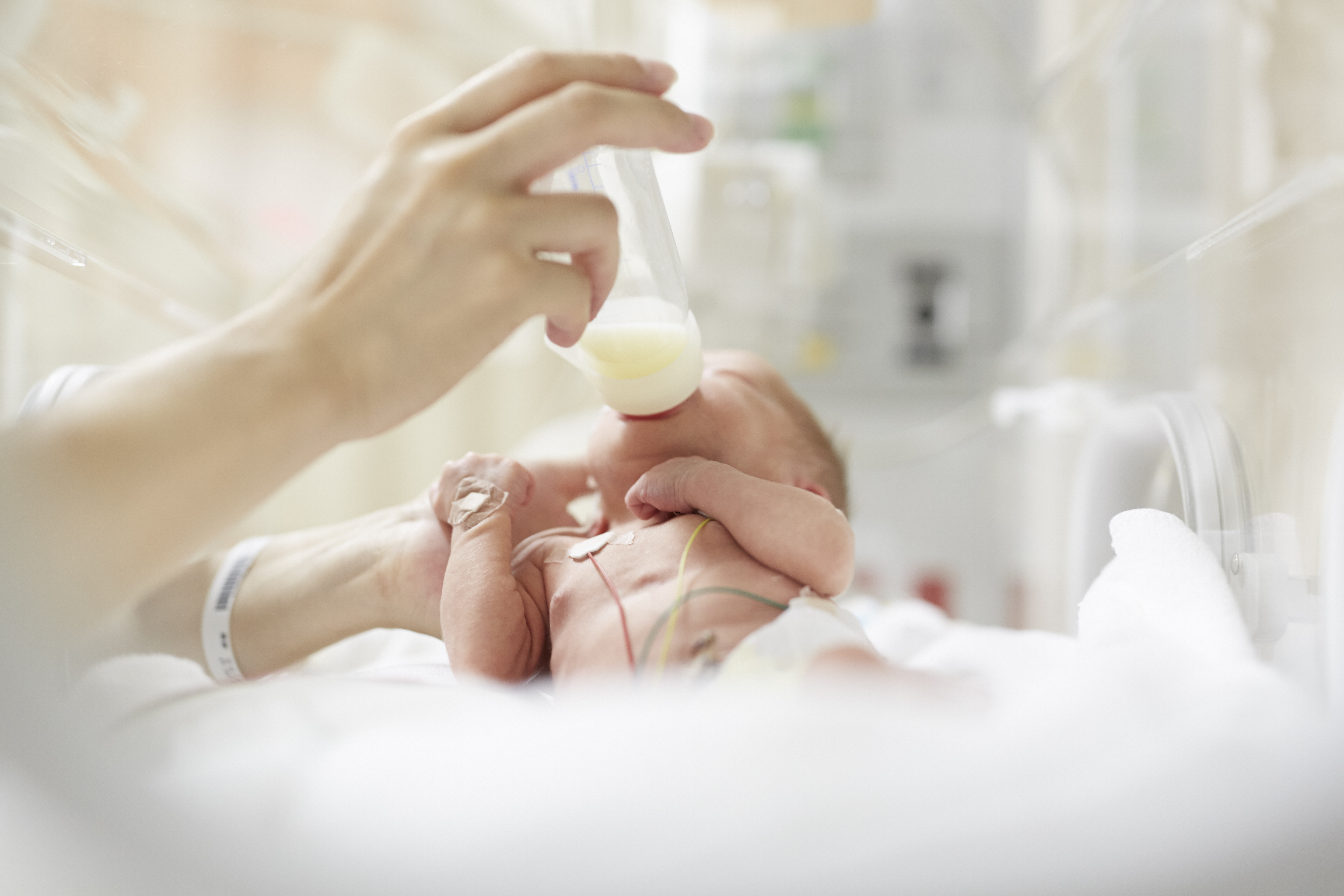 Bebê prematuro sendo alimentado com leite