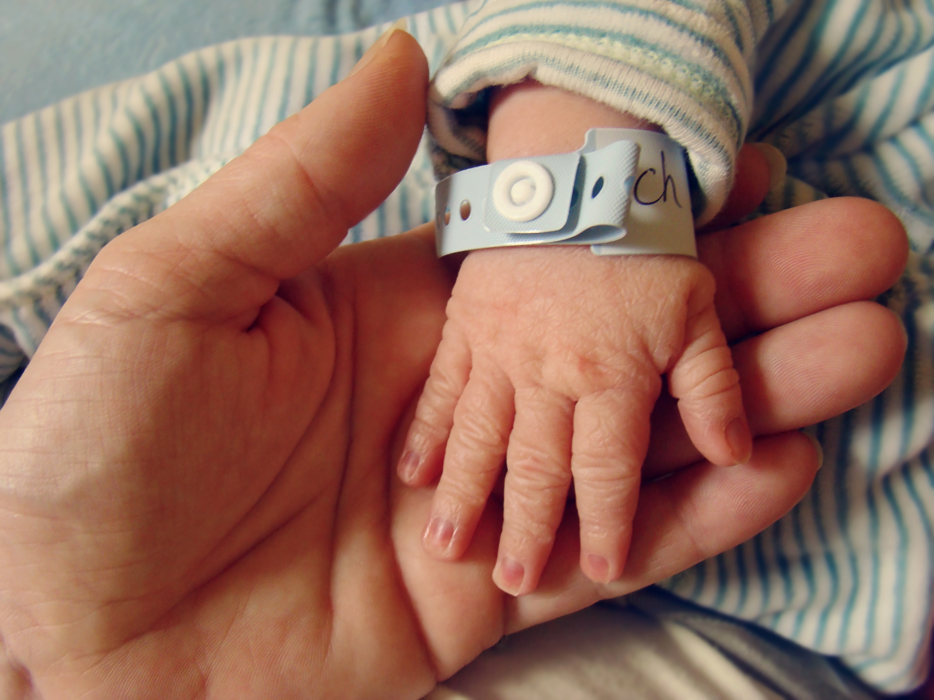 Mão de bebê com pulseira de nascimento