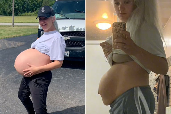 de um lado, a imagem de uma mulher grávida. De outro, a imagem em ângulo parecido, mas após o parto. Ambas com a barriga de fora