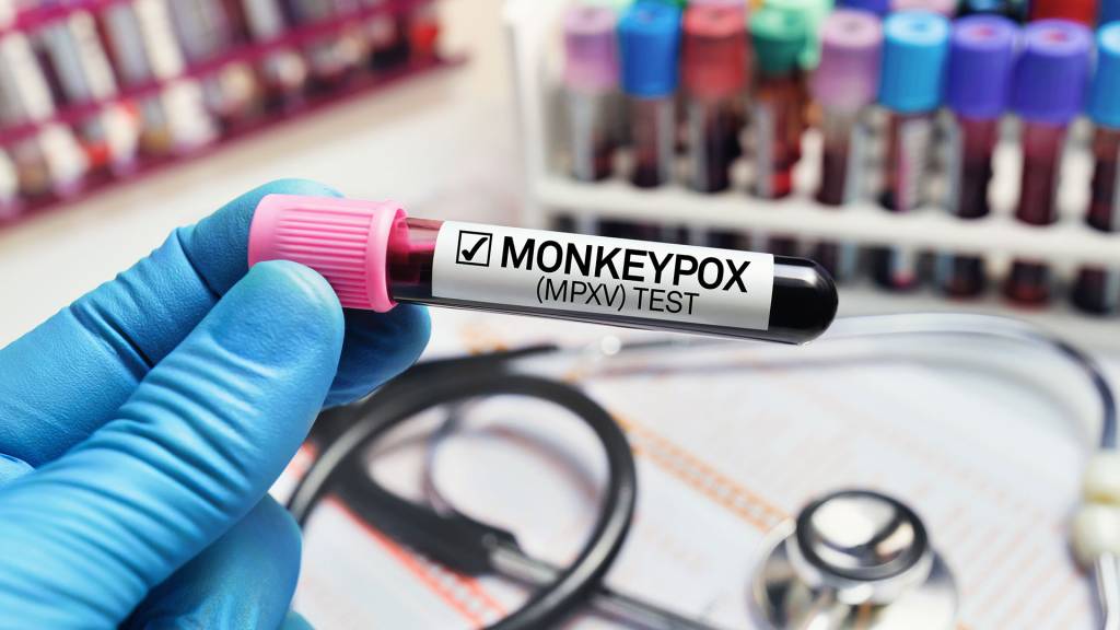 mão com luva azul segura um frasco com sangue dentro em que se lê Monkeypox test. Ao fundo, um estetoscópio e outros frascos desfocados