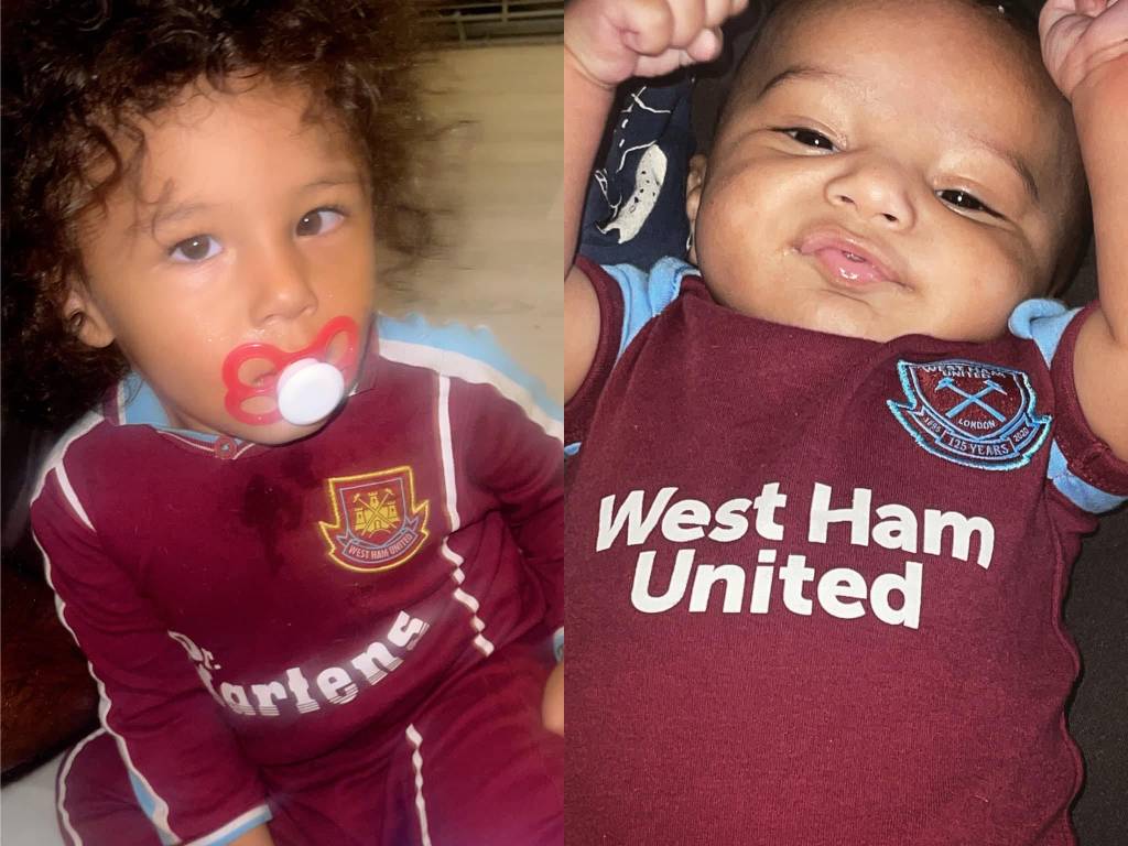 Mãe descobre glaucoma do filho após alerta de mulher nas redes sociais