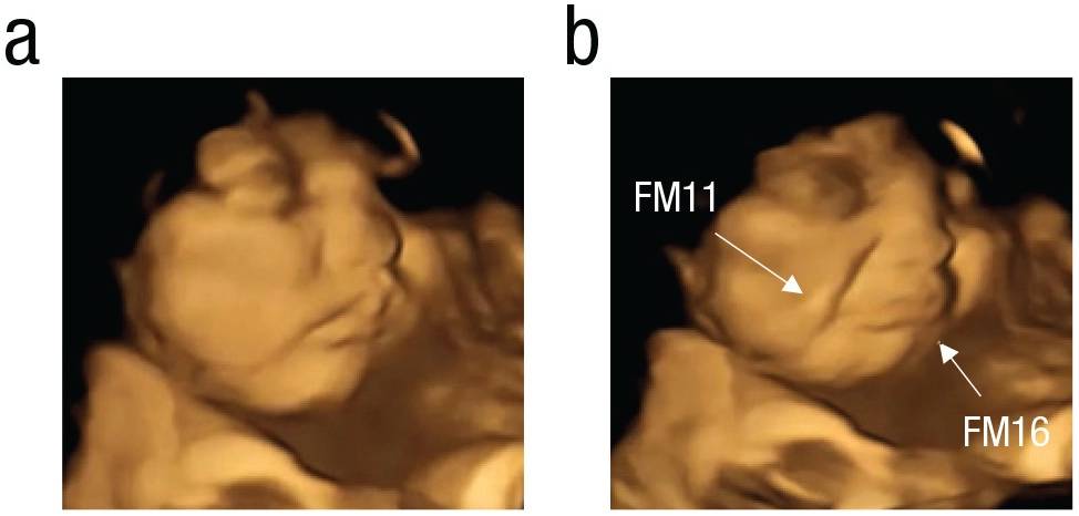 estudo mostra bebês reagindo a gosto e cheiro ainda no útero estudo mostra bebês reagindo a gosto e cheiro ainda no útero