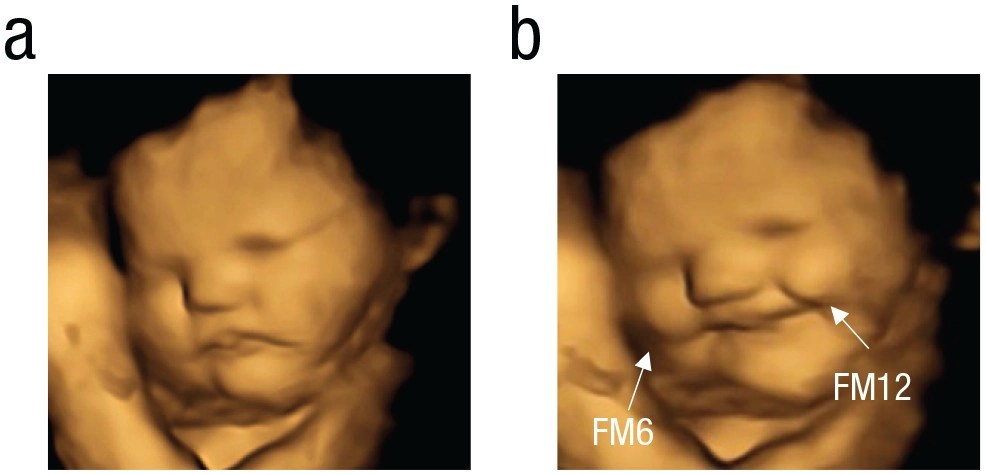 estudo mostra bebês reagindo a gosto e cheiro ainda no útero