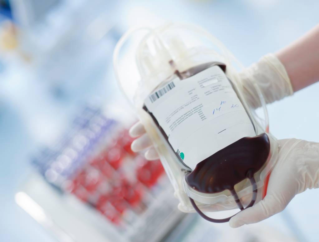 Na foto, duas mãos com luvas cirúrgicas brancas seguram uma bolsa de sangue usada para doação e transfusão. A imagem ao fundo está desfocada.