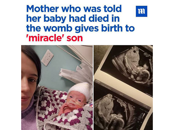 montagem de mulher com bebê no colo e imagens de um exame de ultrassom