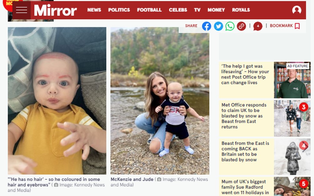 Reprodução de matéria de site inglês. Há duas fotos. À esquerda, a do bebê com sobrancelhas e cabelo desenhados. À direita, a mãe e o bebê com o rosto limpo.
