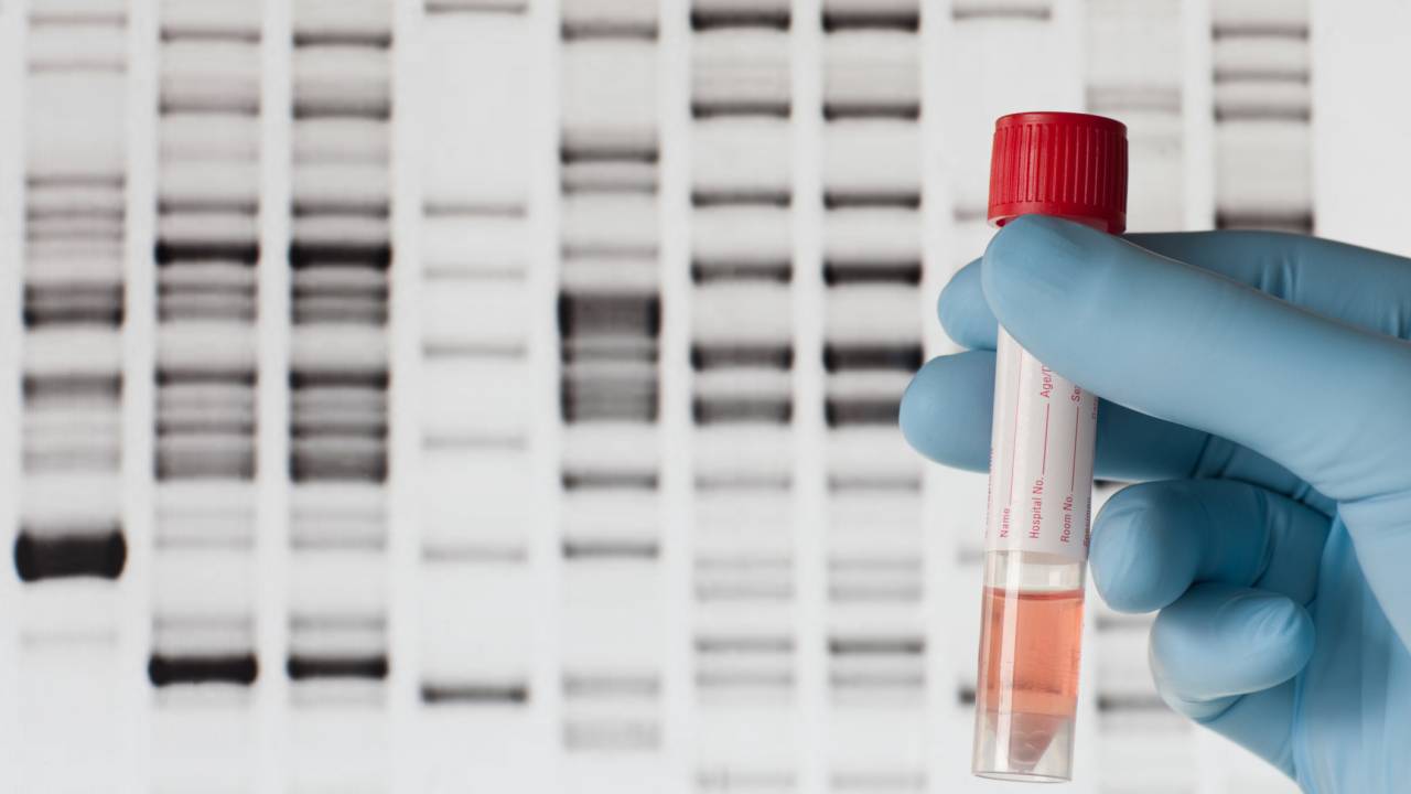 Amostra para teste de DNA em tubo de laboratório. O líquido é vermelho claro.