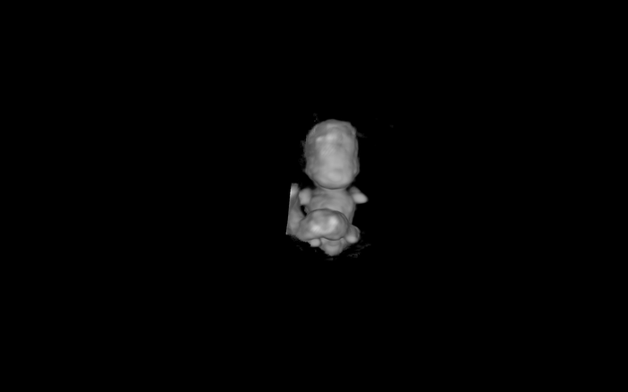 Embrião no útero na 8ª semana de gestação. Imagem criada a partir de ultrassom 3D e tecnologia de realidade virtual. Em um fundo preto, é possível ver um formato que se assemelha a um bebê em formação, branco e cinza, muito pequeno.