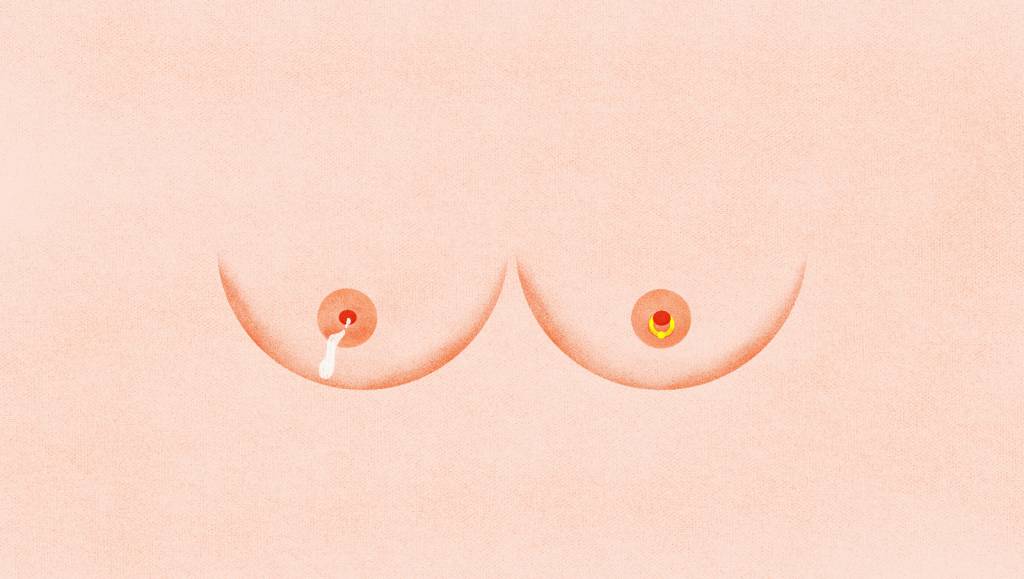 Posso amamentar com piercing no mamilo? Veja tudo o que você precisa saber