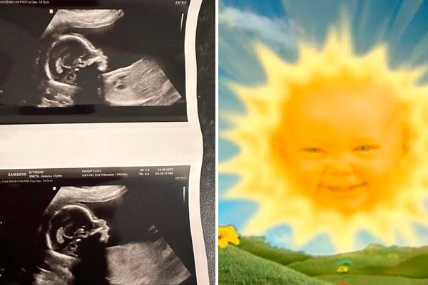 Na imagem, há duas fotos. À esquerda, a imagem de um ultrassom em preto e branco. À direita, cena do programa Teletubbies. Aparece um grande sol em uma paisagem de céu e montanhas. No centro do sol, está a carinha bem grande de um bebê sorridente, de pele clara.